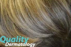 Excessive hair growth - hypertrichosis treatment - Quality Dermatology